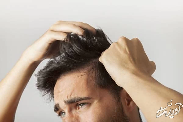 نشانه های کمبود ویتامین سی علائم کمبود ویتامین c
